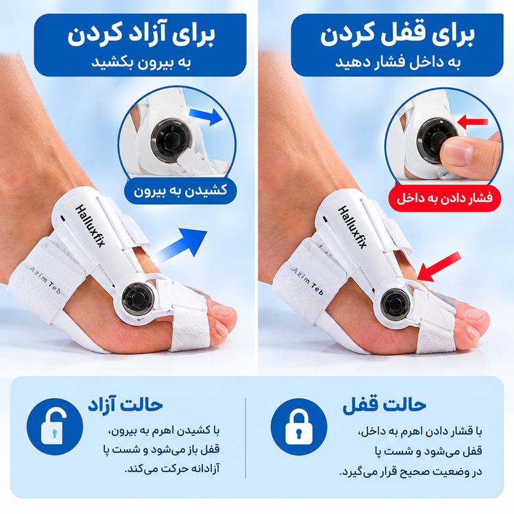 اصلاح کننده انگشت شست پا هالوکس والگوس Halluxfix – عظیم طب